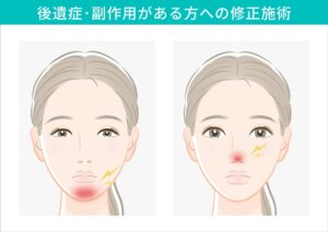 顔に炎症や痛みを抱える女性のイラスト