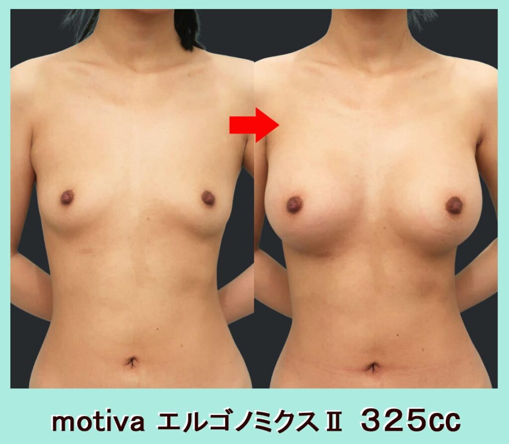motiva エルゴノミクスⅡ ３２５㏄　正面写真