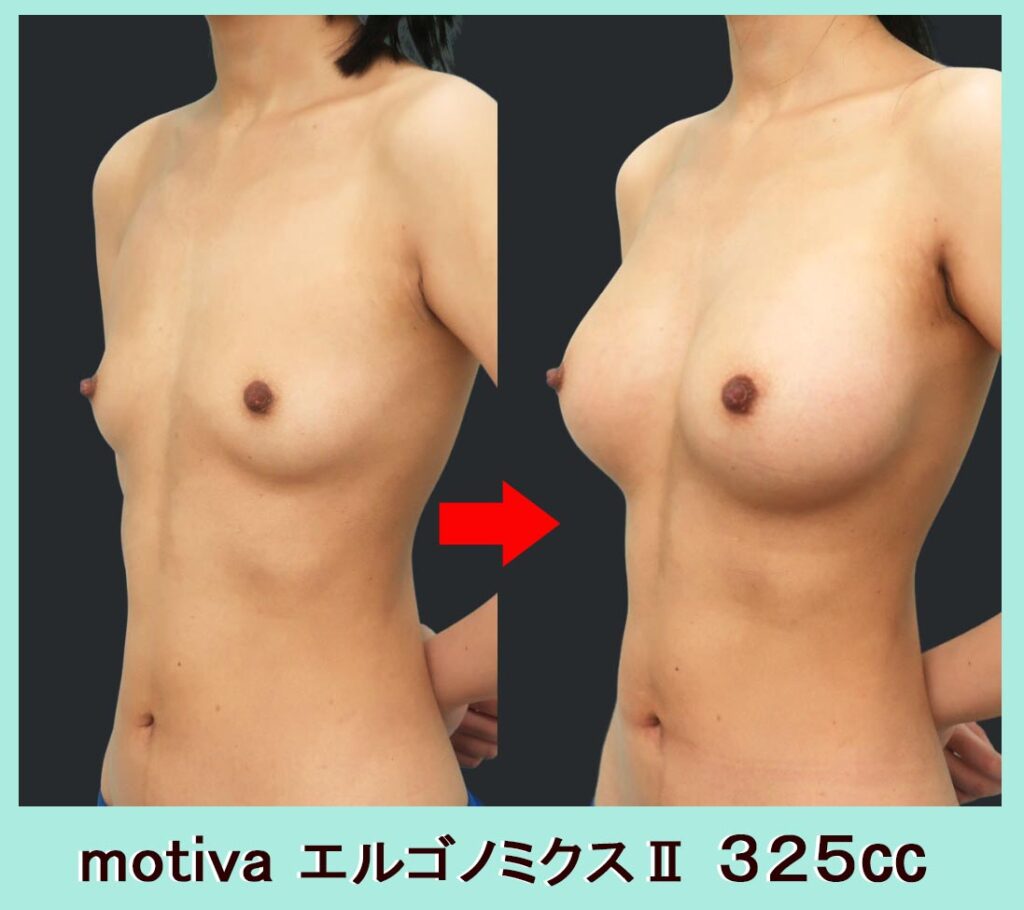 motiva エルゴノミクスⅡ ３２５㏄　斜め写真