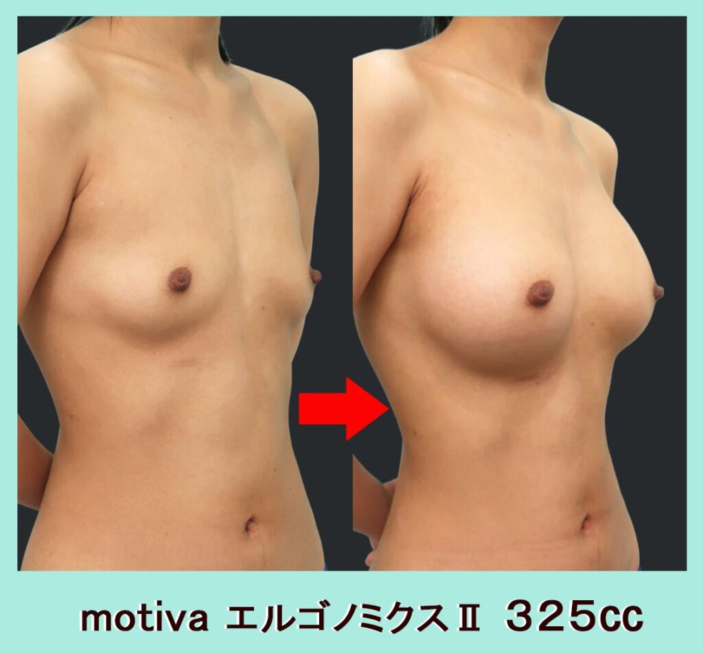 motiva エルゴノミクスⅡ ３２５㏄　斜め写真