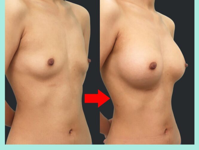 motiva エルゴノミクスⅡ ３２５㏄　斜め写真