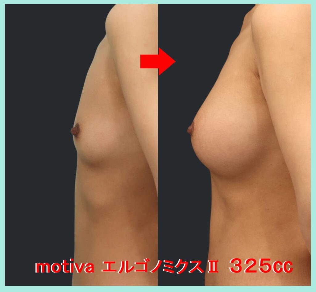 motiva エルゴノミクスⅡ ３２５㏄