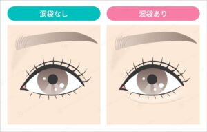 涙袋の有無で比較する目のイラスト