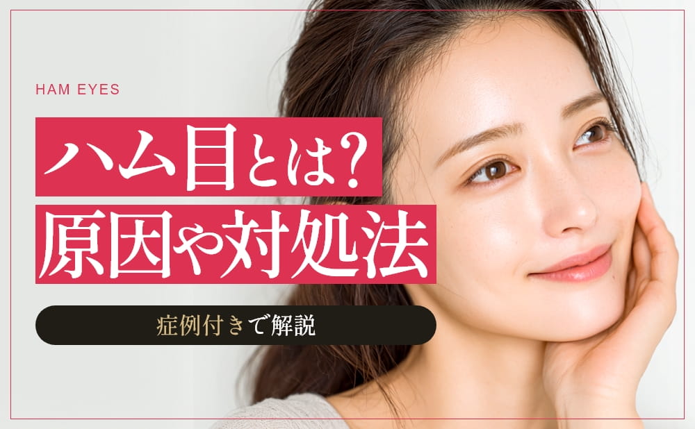 ハム目とはどんな状態？防ぐためには？原因や対処法・他院修正症例を紹介