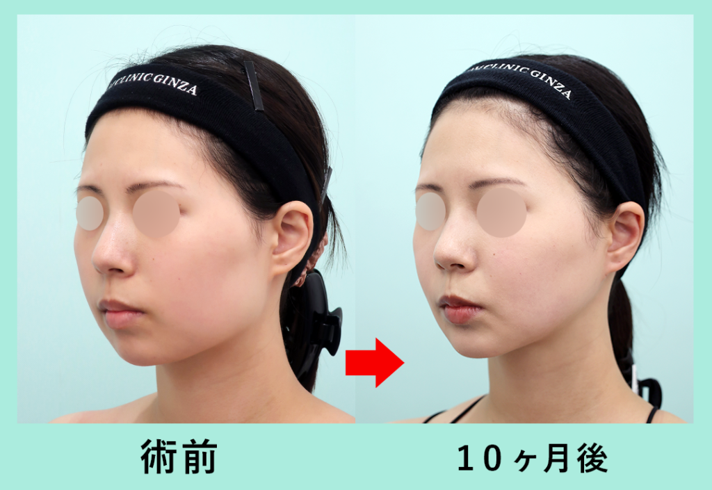 18927_輪郭3点