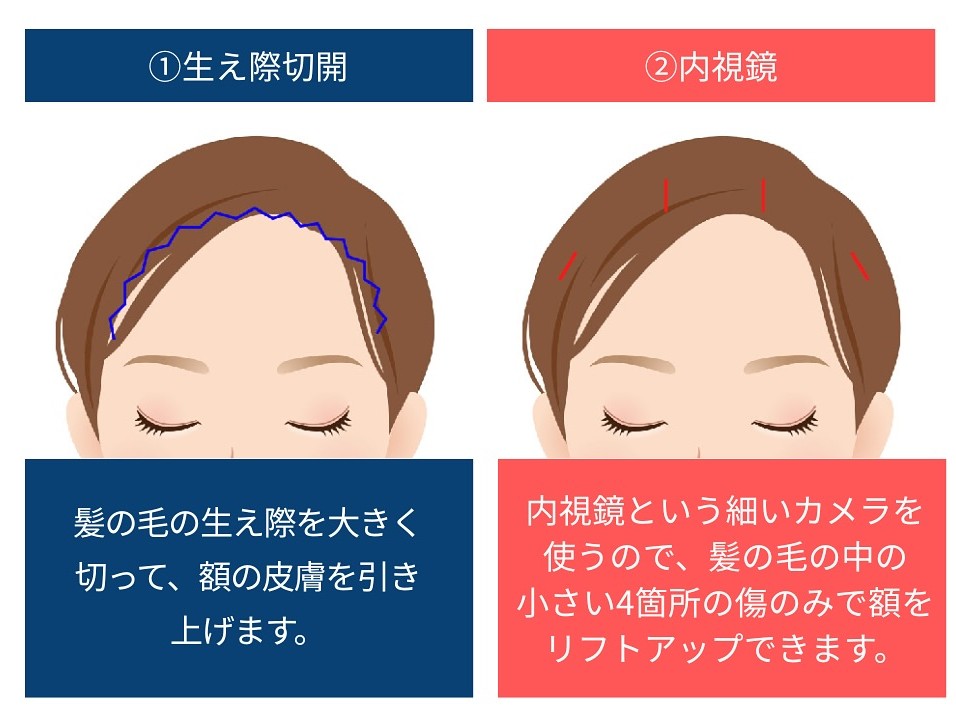 『複数手術経験者が