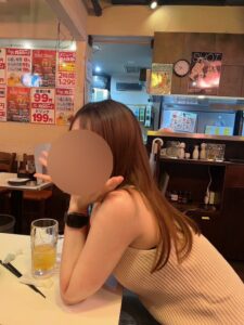 『【二年後の腕は？】脂肪吸引は「リバウンドしない」と言われる医学的理由と長期経過解説。』の画像