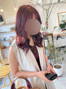 『【二年後の腕は？】脂肪吸引は「リバウンドしない」と言われる医学的理由と長期経過解説。』の画像