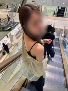 『【二年後の腕は？】脂肪吸引は「リバウンドしない」と言われる医学的理由と長期経過解説。』の画像