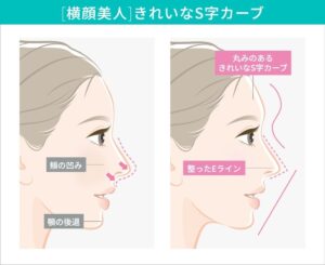 美しいS字カーブとEラインの顔の側面