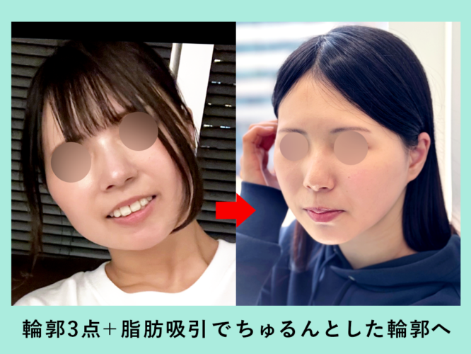 18927_輪郭3点