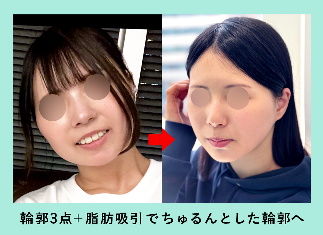 18927_輪郭3点
