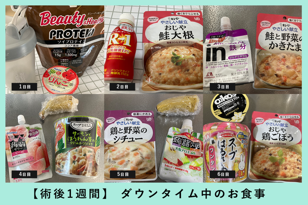 『エラの張り出しを解消！【 Vライン形成＋頬顎脂肪吸引 】』の画像
