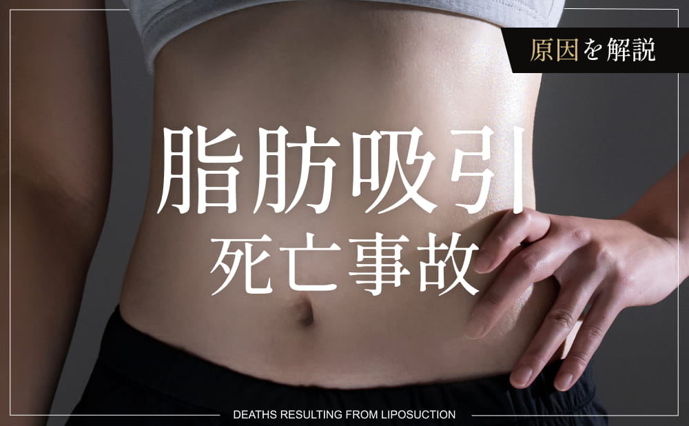 脂肪吸引で死亡事故が起こる？事故が起こるリスクや原因、安全に施術を受ける方法とは