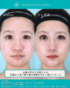 整形手術のビフォーアフターと料金表05