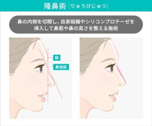 隆鼻術の術前と術後の鼻の高さを示す図
