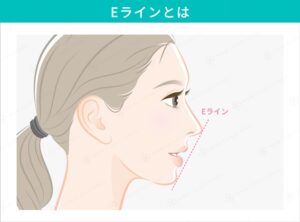女性の横顔とEラインを示す点線
