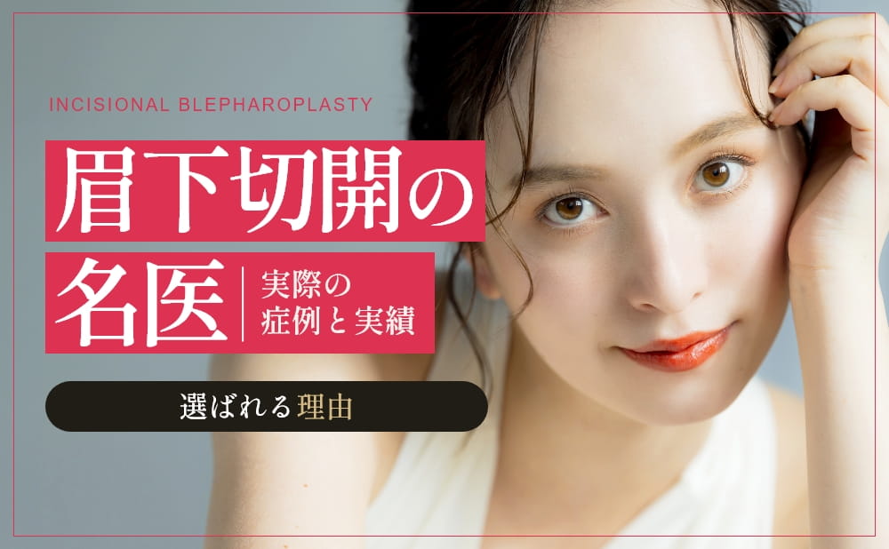 眉下切開の名医・形成外科専門医「髙田怜」医師が選ばれる理由｜眉下切開の症例と実績をご紹介