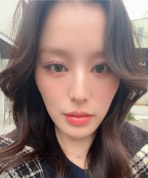 骨切りで女性らしさUP BEFORE写真