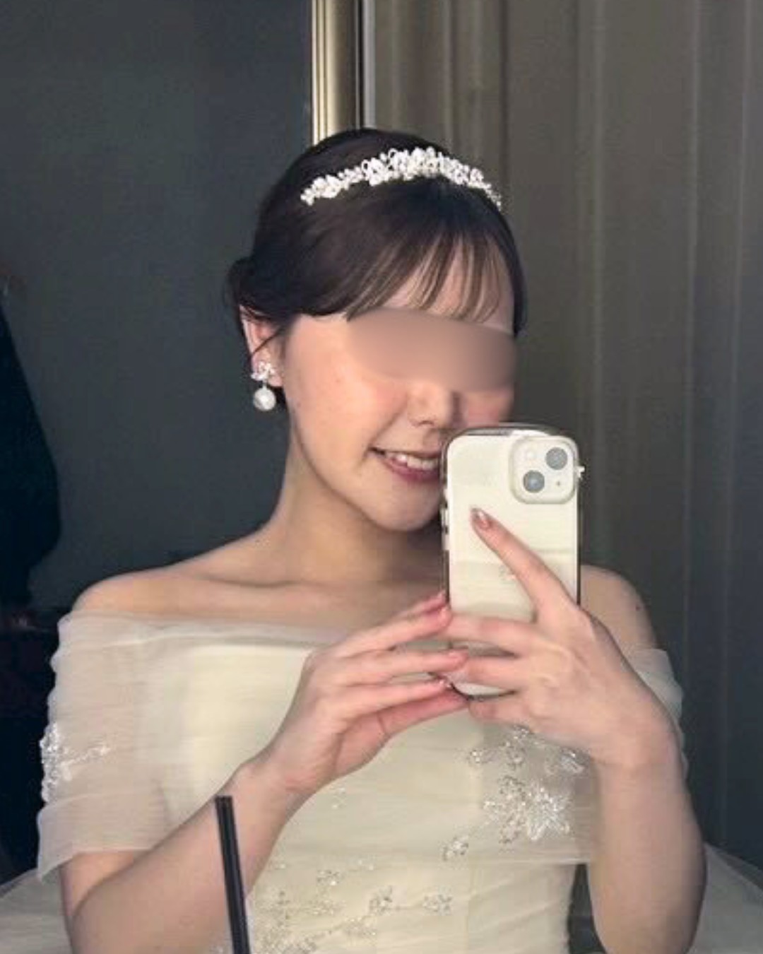 脂肪吸引で笑顔洗練 AFTER写真