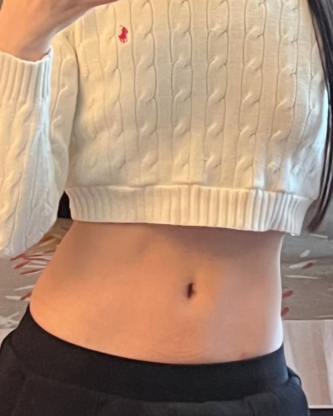 むっちり感解消 BEFORE写真