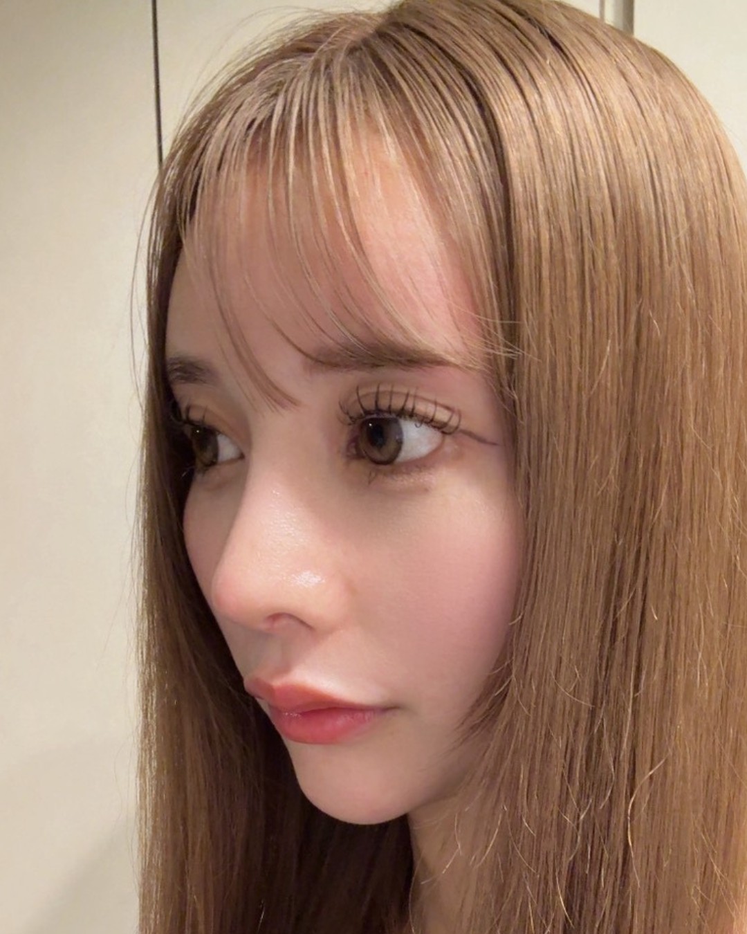 鼻の穴の左右差・曲がり・鼻通りの改善を同時に AFTER写真