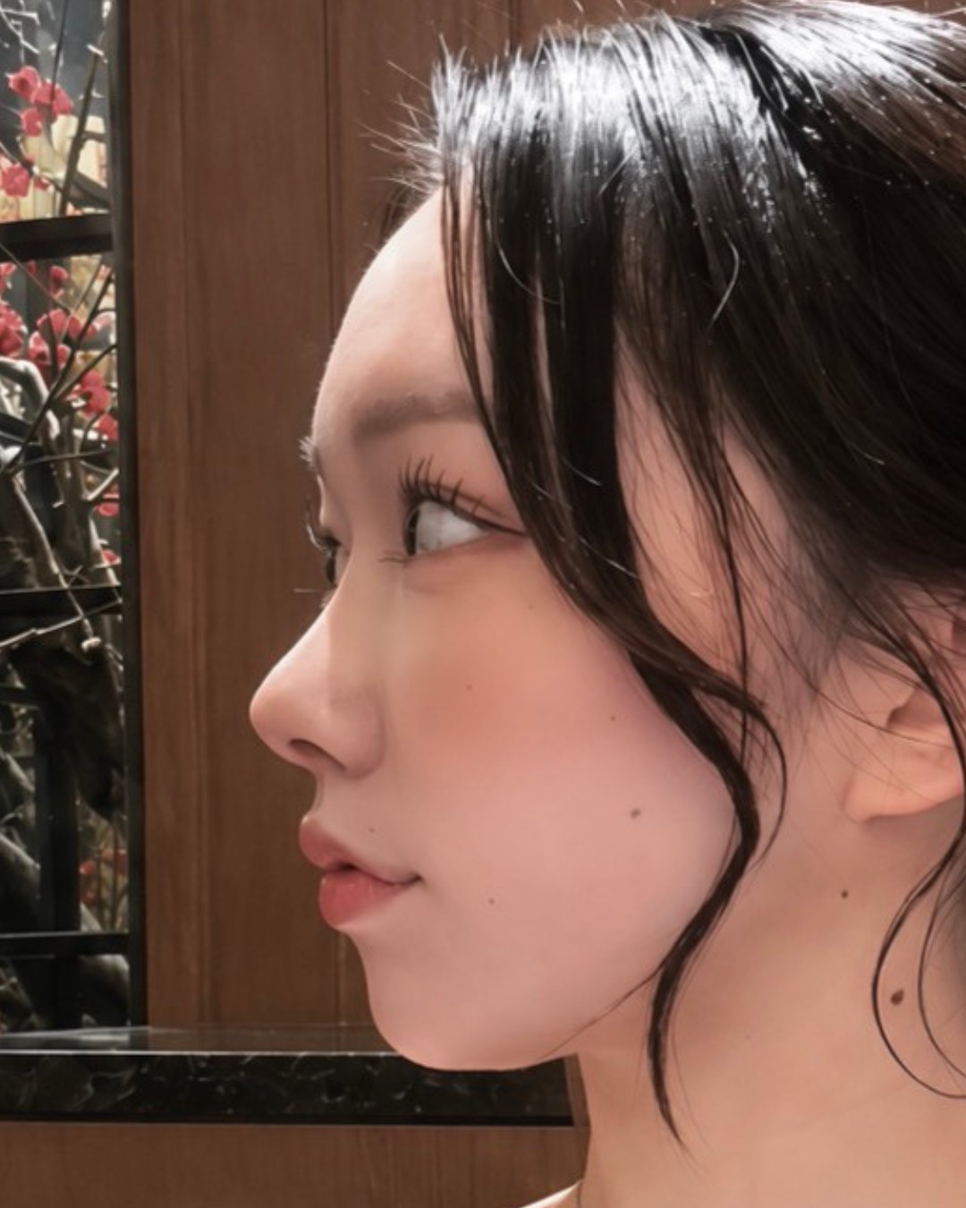 短い鼻・鼻の穴が見える状態をバランス良く AFTER写真