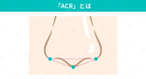 ACRバランスの基準を示す画像