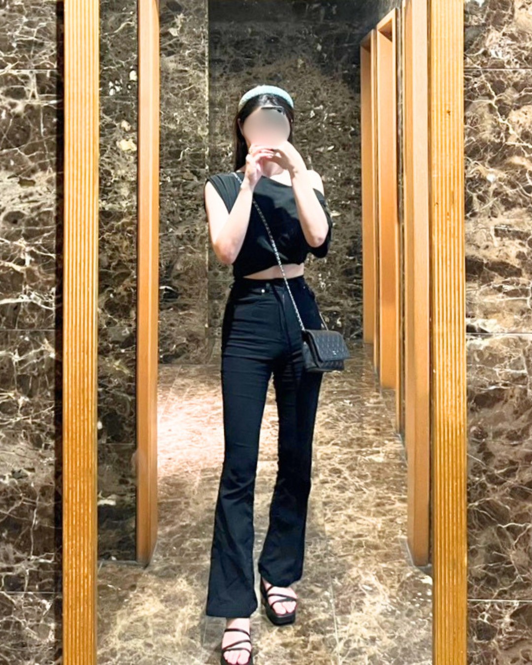 脚フル脂肪吸引 BEFORE写真
