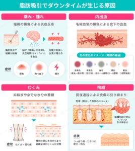 脂肪吸引後のダウンタイムの発生原因と症状