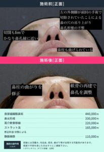 他院修正のビフォーアフター
