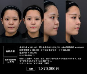 美容整形ビフォーアフターと料金表01
