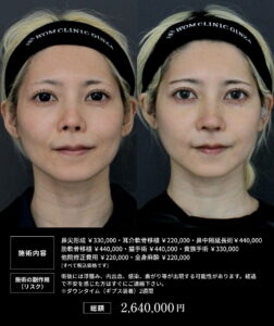 美容整形ビフォーアフターと料金表02
