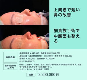 美容整形ビフォーアフターと料金表03