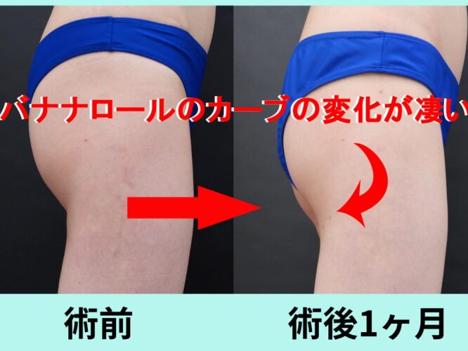 バナナロール修正