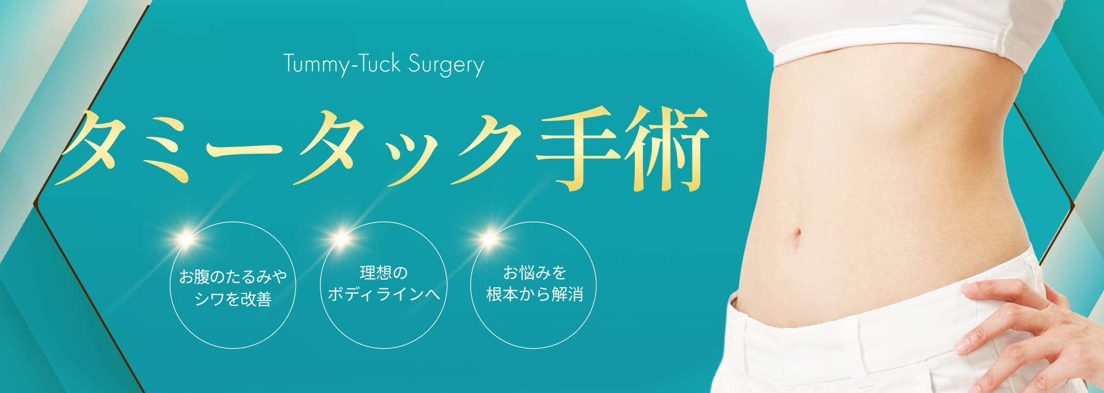 タミータック手術​