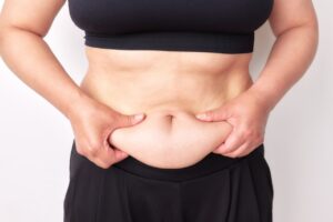女性が自身の腹部をつまんでいる