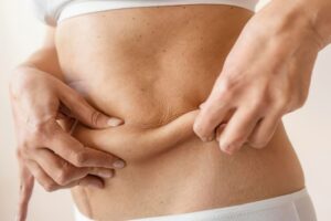 女性がお腹の肉をつまんでいる