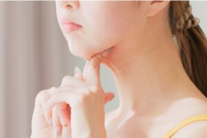 女性が顎を触っている様子
