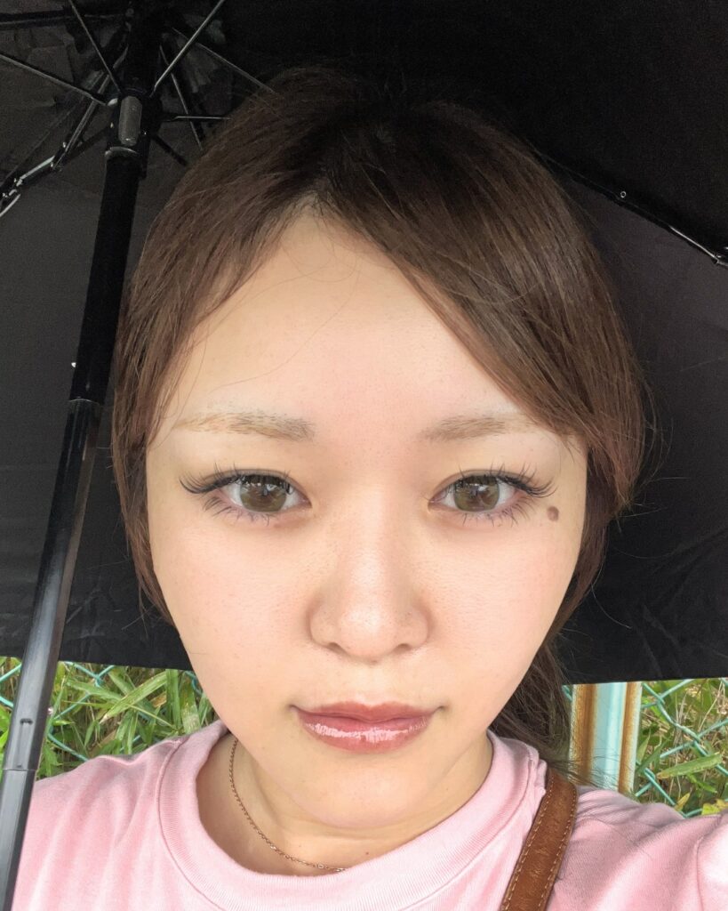 瞼の重みを改善 BEFORE写真
