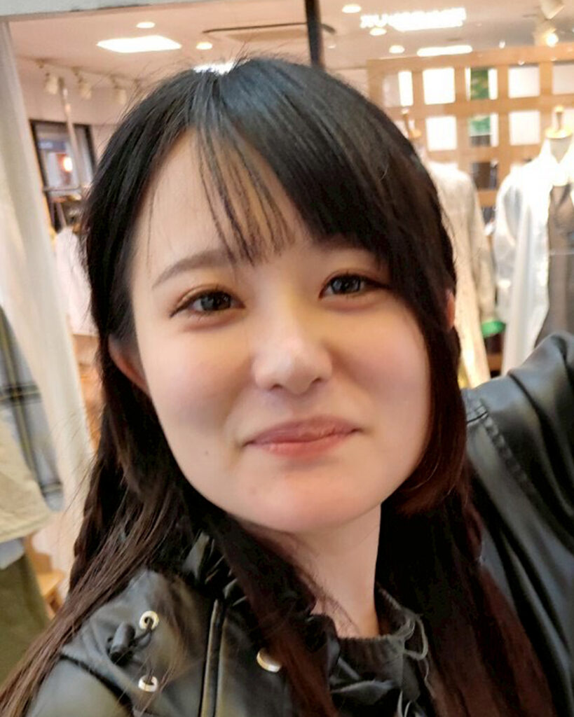 骨切りで角のない輪郭へ BEFORE写真
