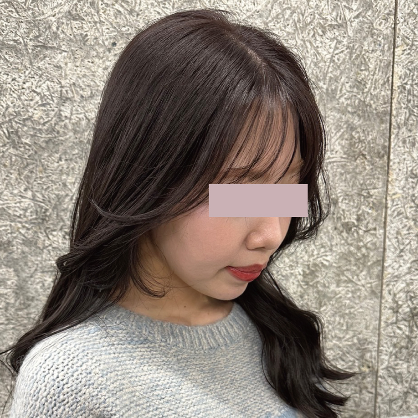 ピタッとした輪郭で垢抜ける BEFORE写真