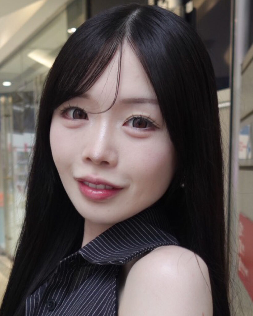 自信が生まれる鼻 BEFORE写真