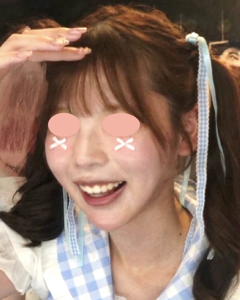 かわいさそのまま、すっきり小顔へ AFTER写真