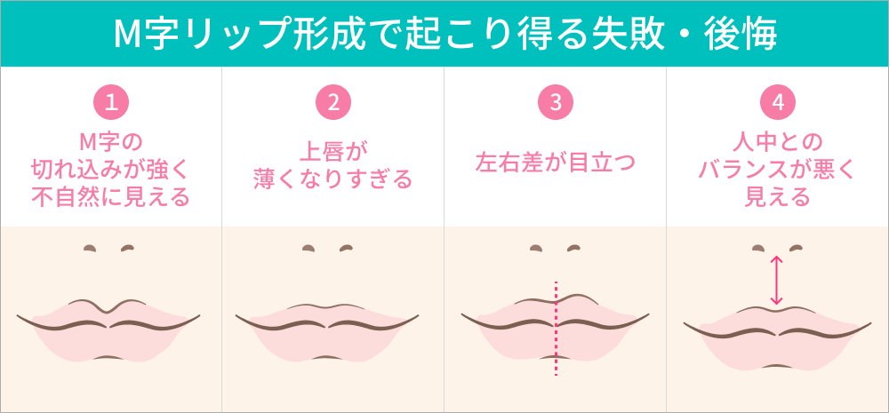 M字リップ形成術の失敗と後悔