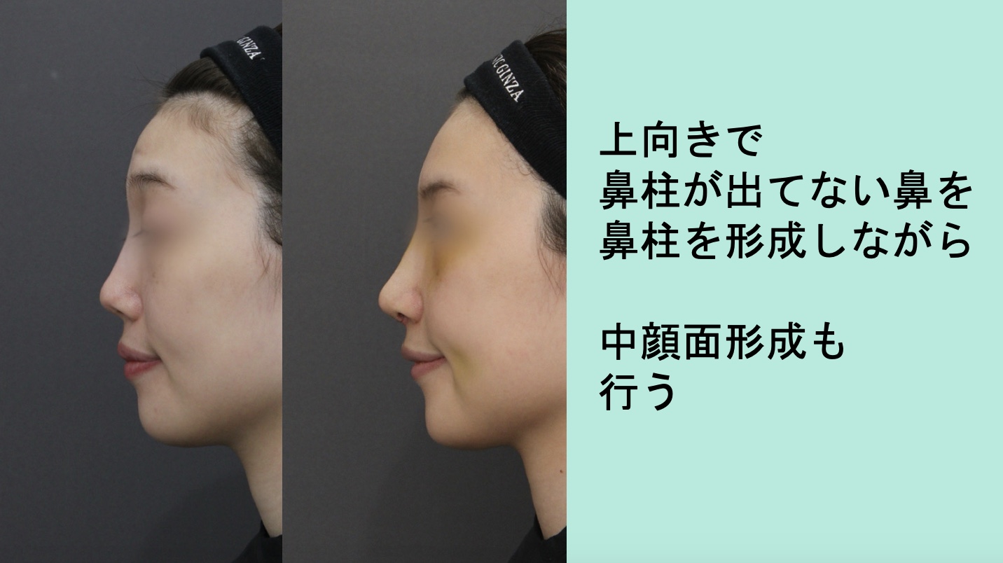 『ACRを整えながら綺麗なバランスにするためには?』の画像