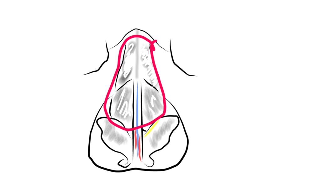 『【初回鼻整形】鼻を細く・高くするには骨から整える 骨切り幅寄せ×自家組織でつくる立体的で洗練された鼻』の画像